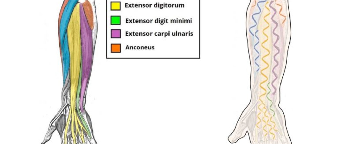 Graphic showing anatomy of human and orthotic arms